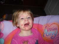 impetigo rash on baby